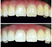 Клиника лазерной медицины на Туристской улице Фотография 2