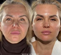 Клиника эстетической медицины Misha clinic Фотография 2