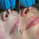 Клиника пластической хирургии и косметологии Wilson Clinic Фотография 5