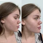 Клиника пластической хирургии и косметологии Wilson Clinic Фотография 7
