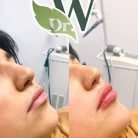 Клиника пластической хирургии и косметологии Wilson Clinic Фотография 3