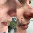 Клиника пластической хирургии и косметологии Wilson Clinic Фотография 6